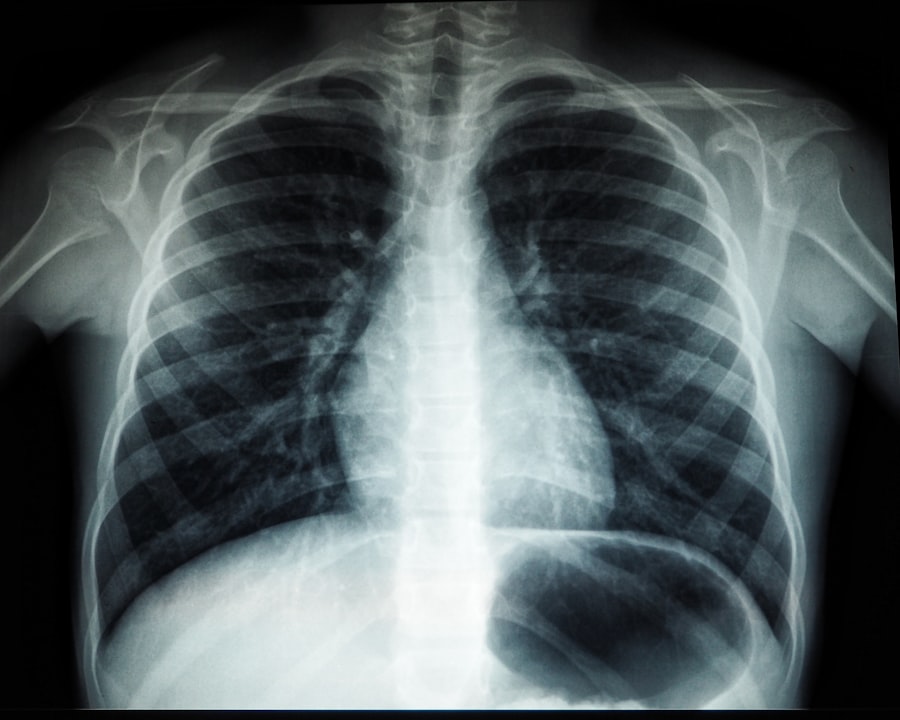 stabilitate pe termen lung